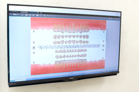 西京区上桂駅・ほんだ歯科クリニック・説明用ソフト(トリニティコア)