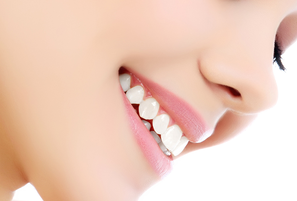 西京区上桂駅・ほんだ歯科クリニック・参考金額